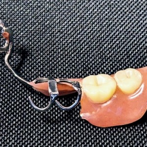 40万円の入れ歯を作った老人が半月後に亡くなった話を聞いて前者後者の解釈